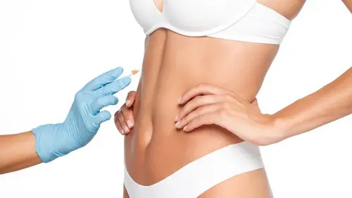 πλαστική μετά από κοίλανση