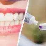 Με ή χωρίς φθόριο: ο οδοντίατρος απάντησε σαφώς ποια πάστα